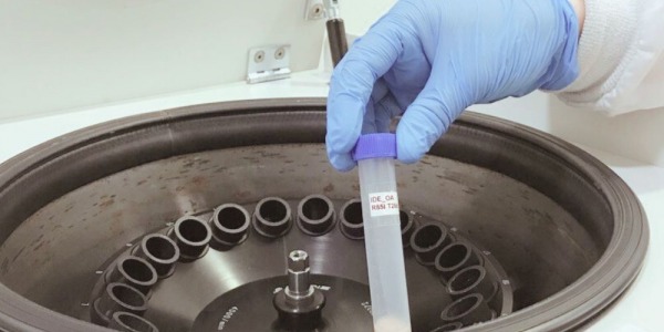 CRONIC-DSP Project Advances in Assessing Marine Toxins' Effects